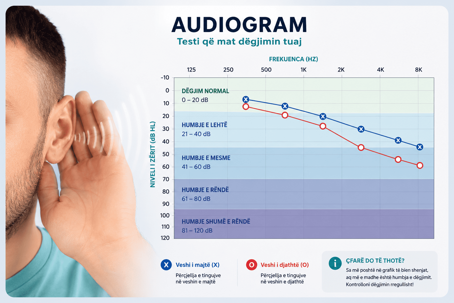 Shpjegimi i audiogramës